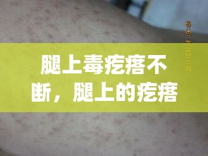 腿上毒疙瘩不斷，腿上的疙瘩特別特別多為什么 