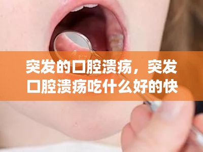 突發(fā)的口腔潰瘍，突發(fā)口腔潰瘍吃什么好的快 