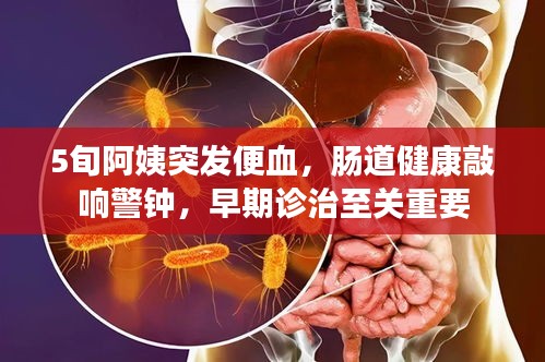 5旬阿姨突發(fā)便血，腸道健康敲響警鐘，早期診治至關(guān)重要